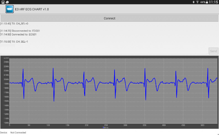 ecg3